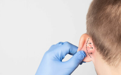 Otoplasty Surgery: Reshaping Your Ear Aesthetics for a Confident You